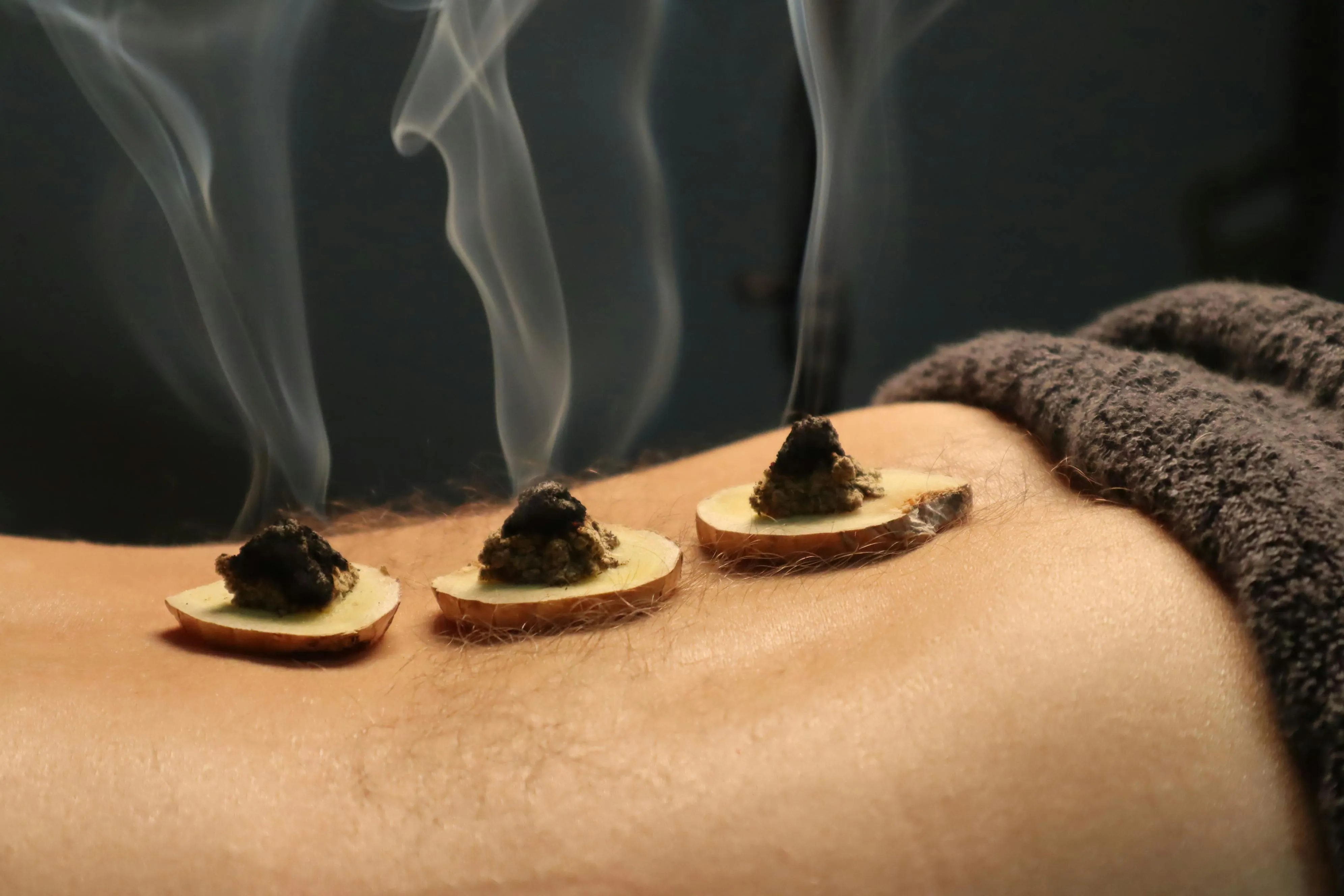 Moxa aplicada con jenjibre en la zona lumbar